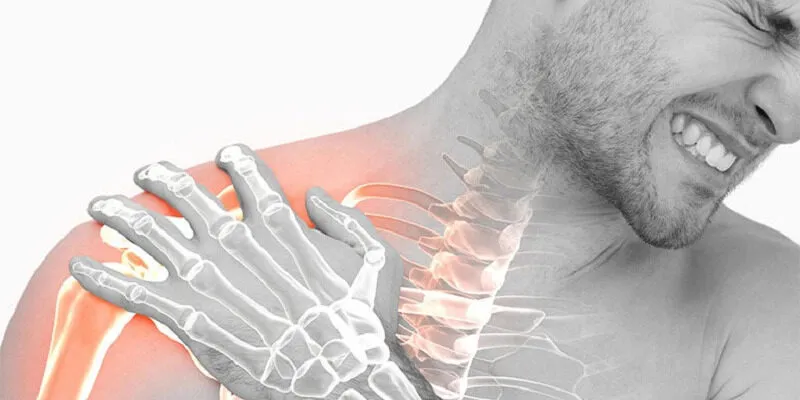 Viêm quanh khớp vai